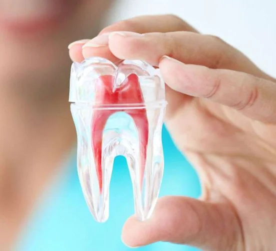 Best Root Canal Treatment in Mumbai at Opal Dental Care Studio